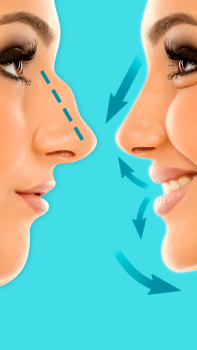 تحميل تجميل الأنف: محرر الأنف الجمال لنظام أندرويد لقطة شاشة 4