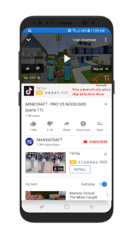Skip Ads